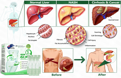 𝗢𝗳𝗳𝗶𝗰𝗶𝗮𝗹 𝗦𝘁𝗼𝗿𝗲 | 𝙇𝙤𝙩𝙢𝙖𝙮® G𝑳P-1 𝑴𝒆𝒕𝒂𝒃𝒐𝒍𝒊𝒄 𝑩𝒂𝒍𝒂𝒏𝒄𝒆 𝑶𝒓𝒂𝒍 𝑨𝒎𝒑𝒐𝒖𝒍𝒆𝒔 – 1x/day, visible results in 7 days 👑 Supports weight management, heart health, diabetes, sleep, digestion, and joint health. 💎